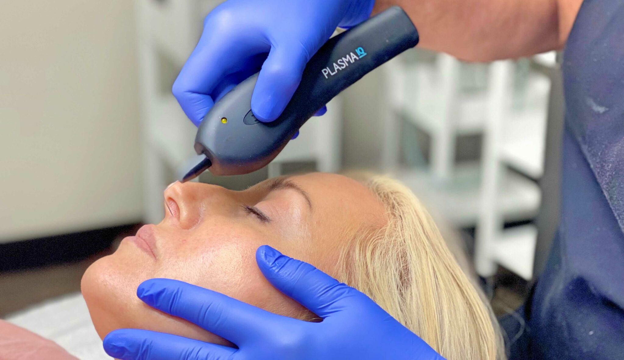 Plasma IQ Treatment in