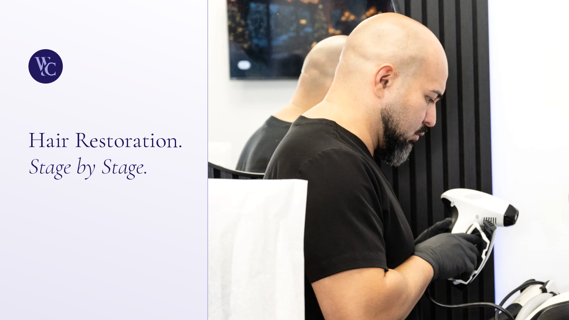 PRP Therapy Hair Restoration Miami